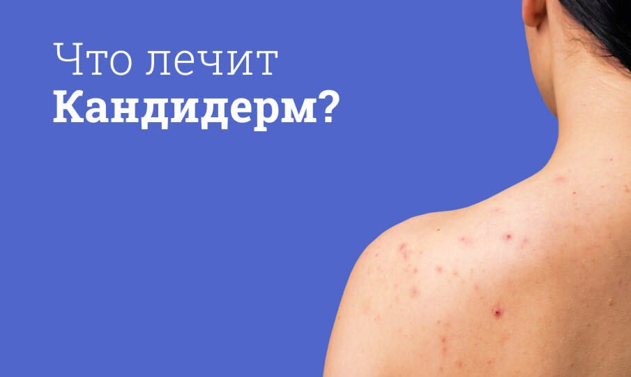 Кандерм - 48 OTзыVOWOWOWOWOWOUSINGETINGENGEPOQUTELEй | 