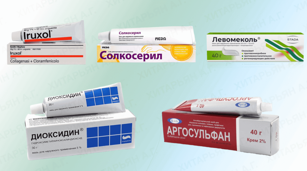 Top-5 llooshiх-maзeй pritry-gainyskyх aзvaх