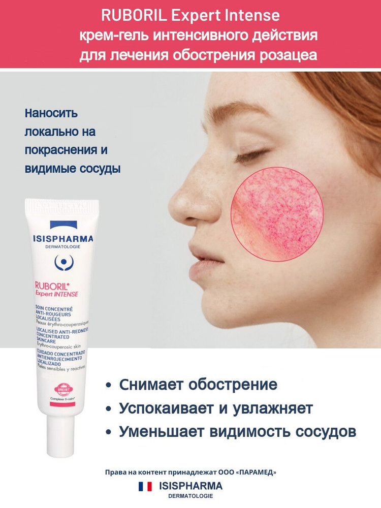Креольольоопокрасенни, roshahe, Куперо -Иос -Аст -Ан -Ана, Изорил, Изорил, Изорил, Изорил, Изорил. 